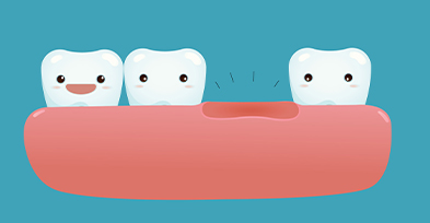 dental-crown-bridge-malaysia-dentistsco